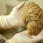 Fotografia mostra um embrião de camundongo com 9,5 dias de idade e representa as duas origens distintas do cérebro durante o desenvolvimento. — Foto: Stanford Medicine