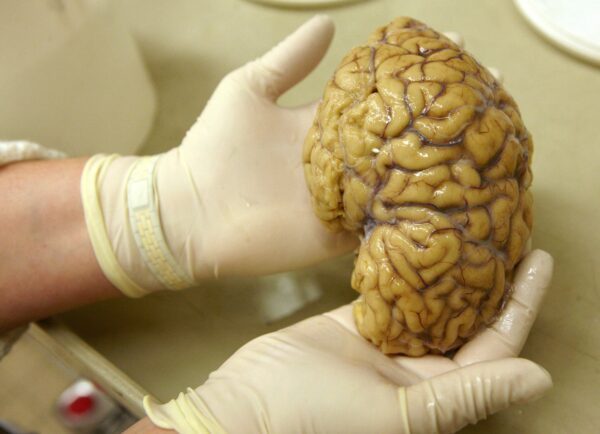 Fotografia mostra um embrião de camundongo com 9,5 dias de idade e representa as duas origens distintas do cérebro durante o desenvolvimento. — Foto: Stanford Medicine
