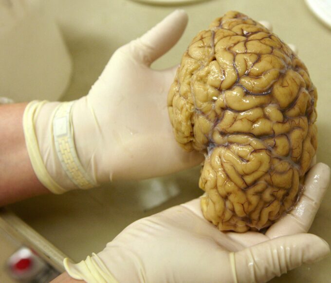 Fotografia mostra um embrião de camundongo com 9,5 dias de idade e representa as duas origens distintas do cérebro durante o desenvolvimento. — Foto: Stanford Medicine